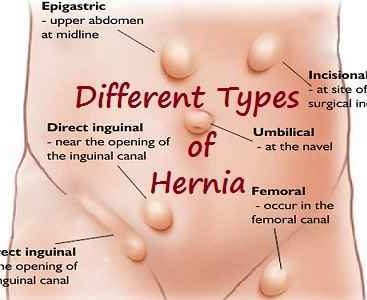 General Laparoscopic Surgeon in Nashik