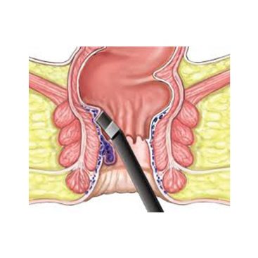 Laparoscopic Surgeon in Nashik