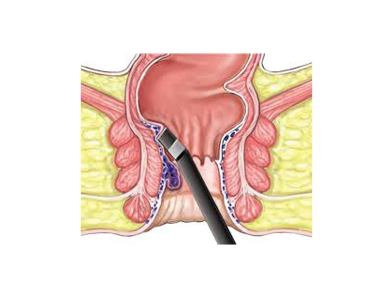 Laparoscopic Surgeon in Nashik